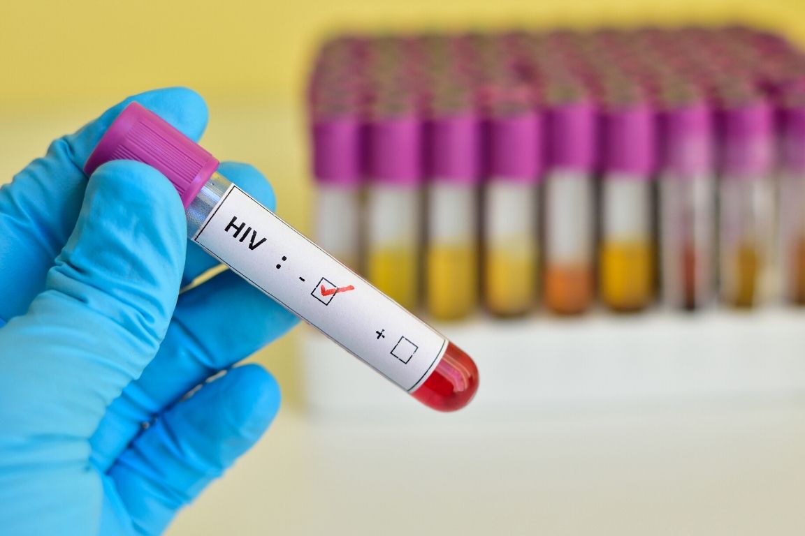 On the Road to an HIV Functional Cure: Lentivirus Modified CD4 T Cells Bring New Hope